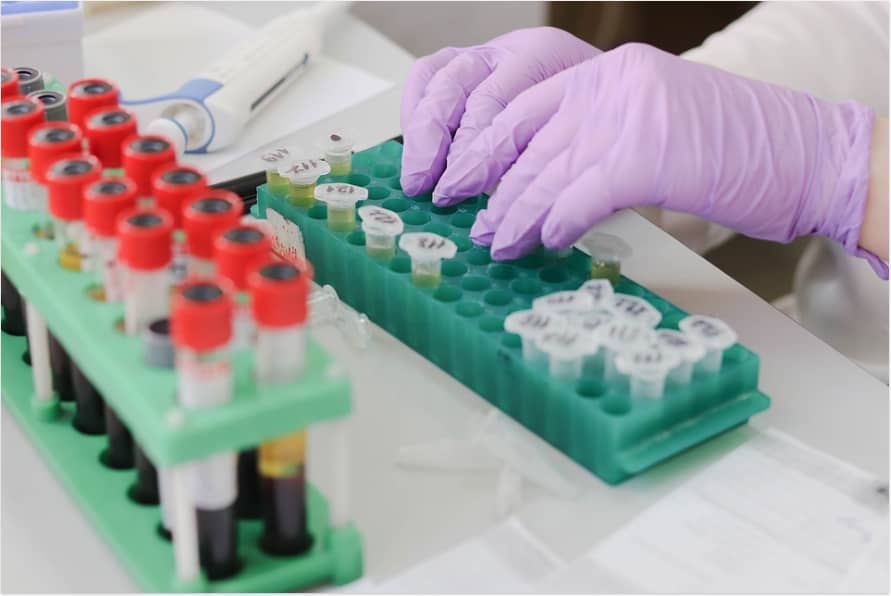 Elisa Kit